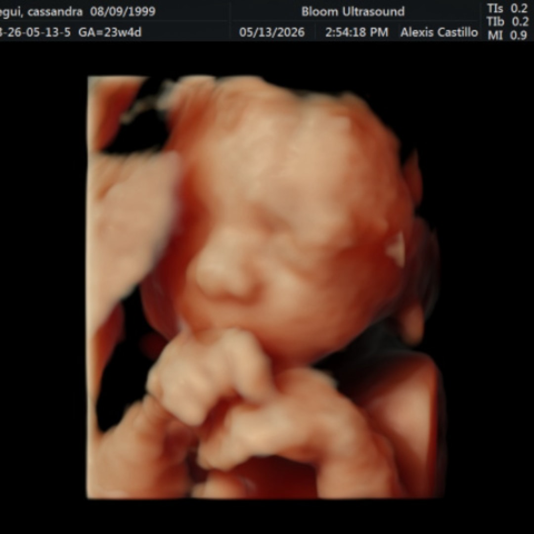 Photo shared by Cassandra for their Babylist baby registry.