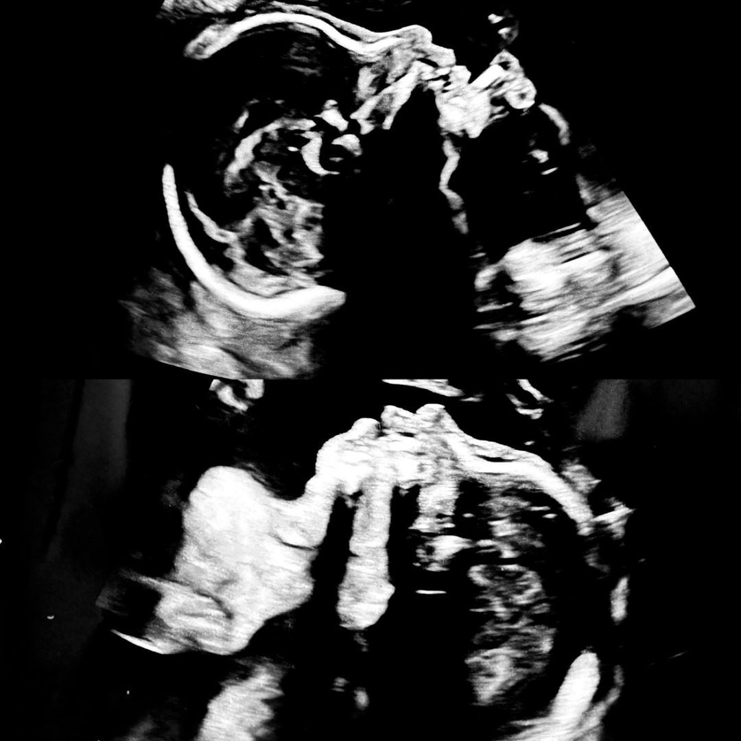 Photo shared by Katie for their Babylist baby registry.