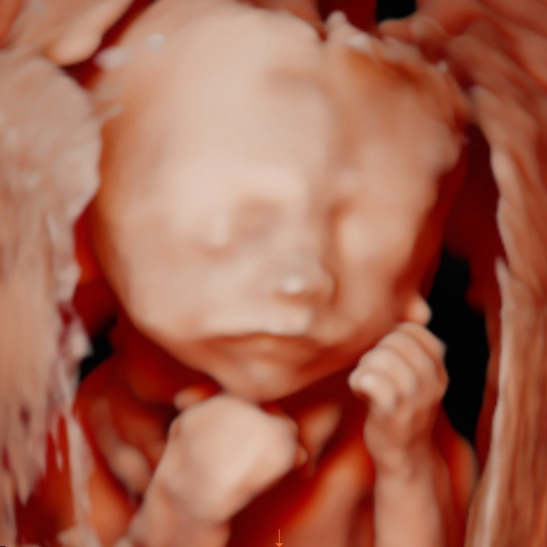 Photo shared by Mckenna for their Babylist baby registry.
