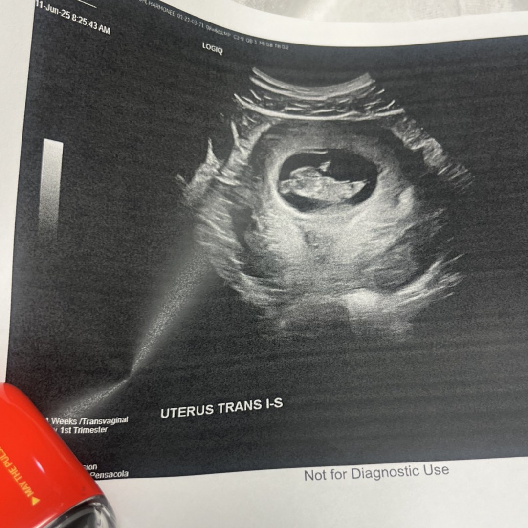 Photo shared by Honey for their Babylist baby registry.