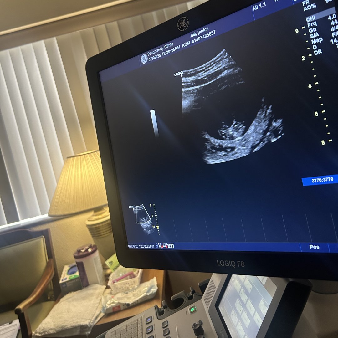 Photo shared by Shyanna for their Babylist baby registry.