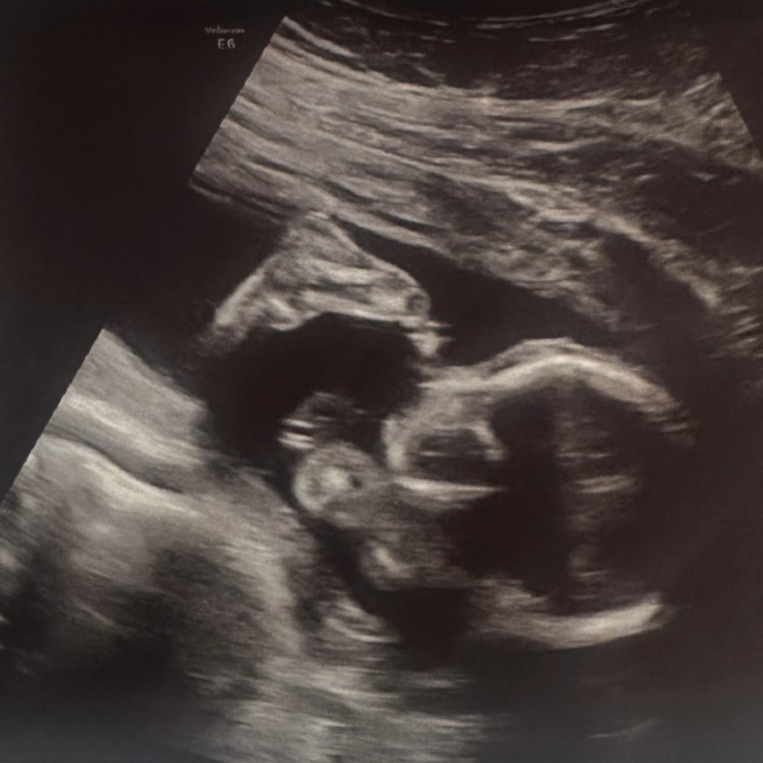 Photo shared by Cody for their Babylist baby registry.