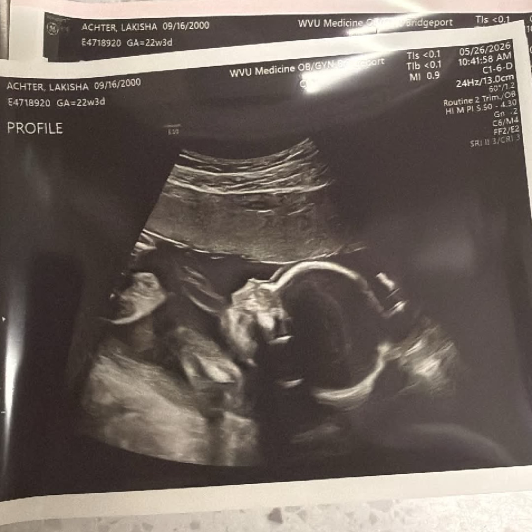 Photo shared by Lakisha for their Babylist baby registry.