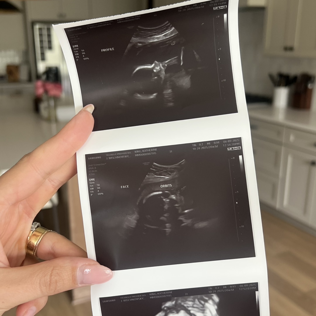 Photo shared by Katie for their Babylist baby registry.