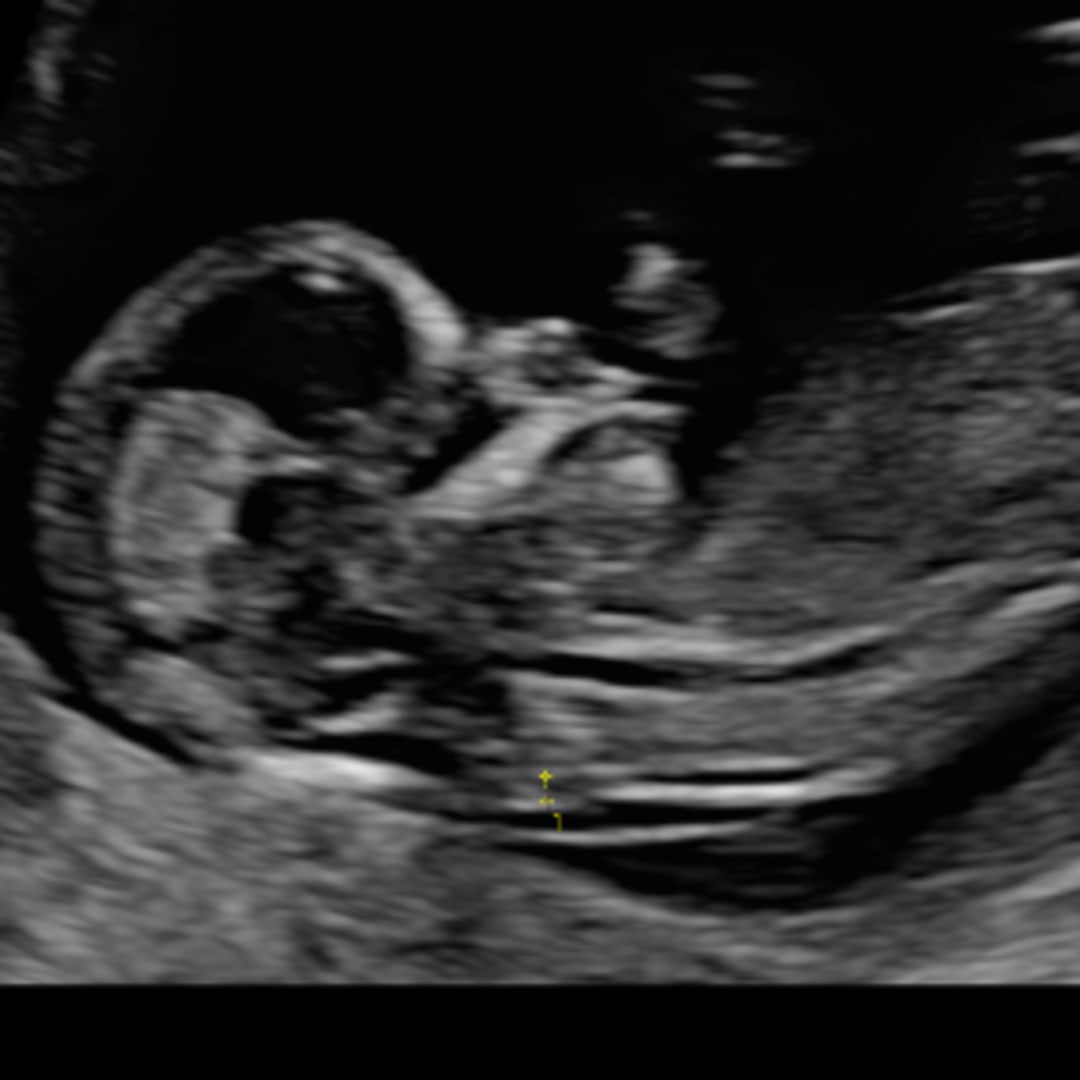 Photo shared by Dajanee for their Babylist baby registry.
