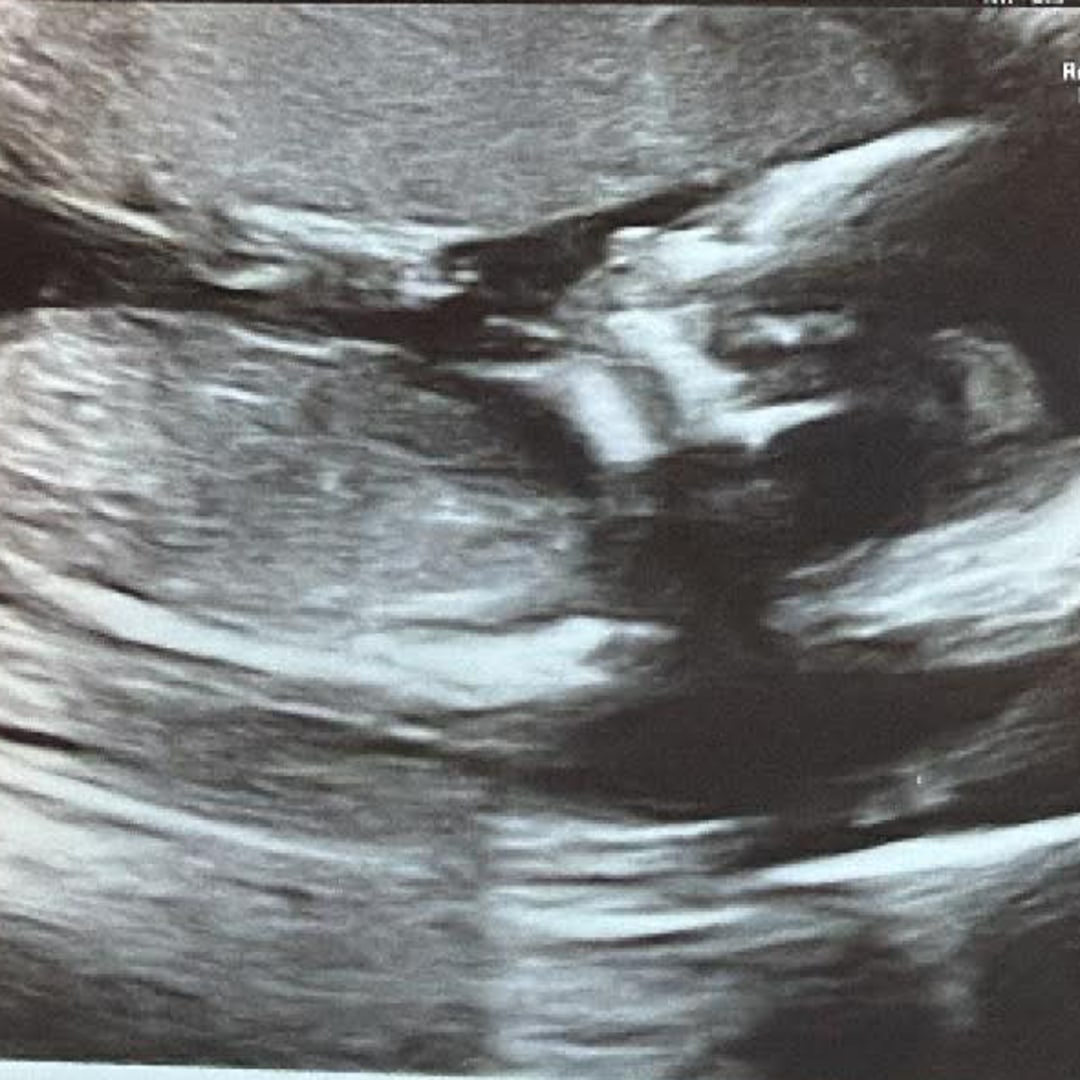 Photo shared by Char-leigh for their Babylist baby registry.