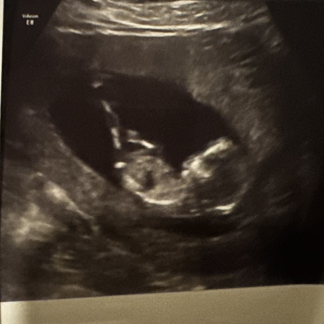 Photo shared by Mackewin for their Babylist baby registry.