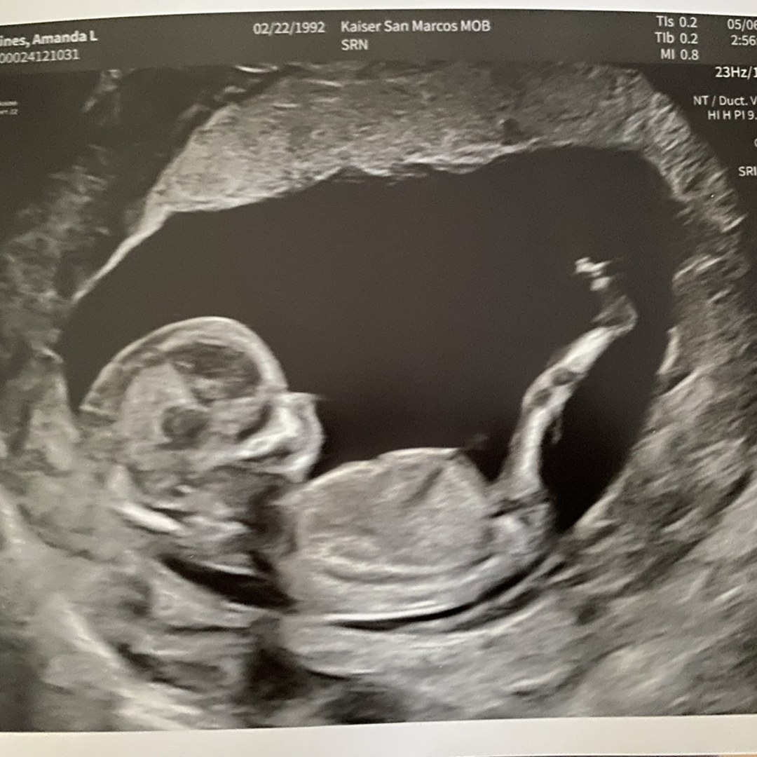 Photo shared by Amanda for their Babylist baby registry.
