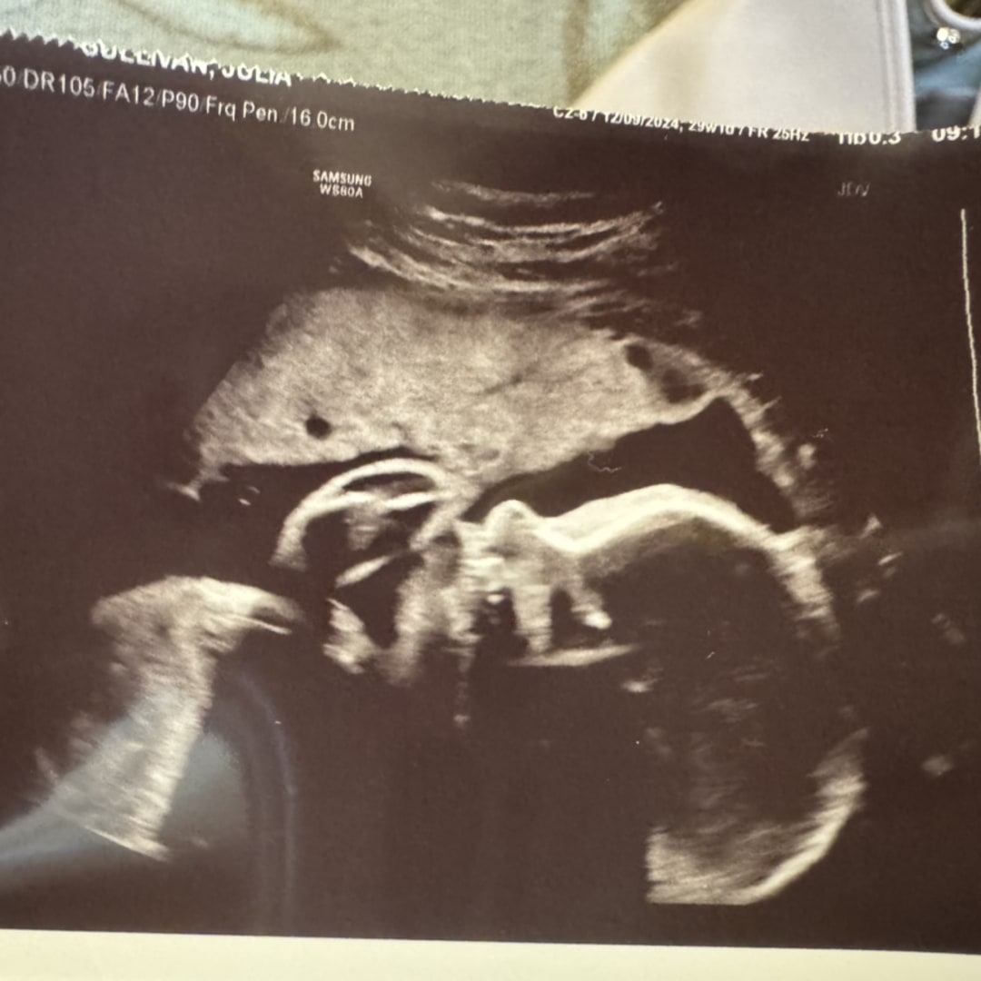 Photo shared by Julia for their Babylist baby registry.