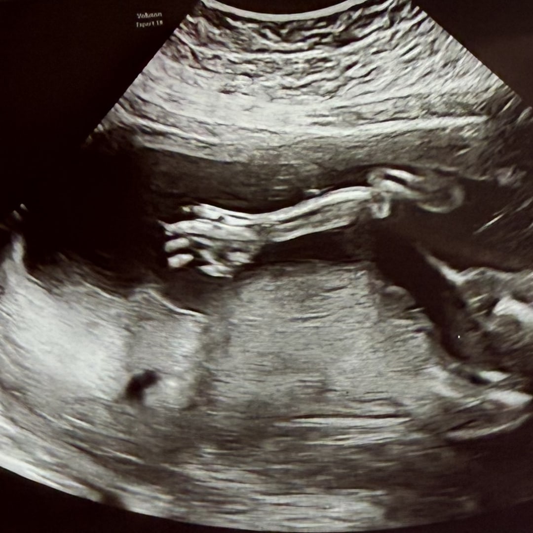 Photo shared by Quinley for their Babylist baby registry.
