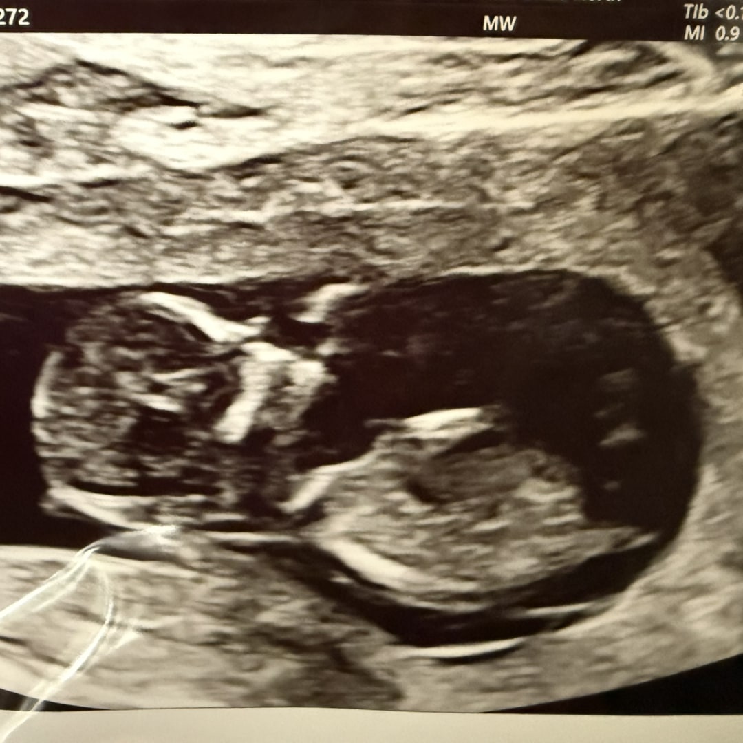 Photo shared by Cristian for their Babylist baby registry.