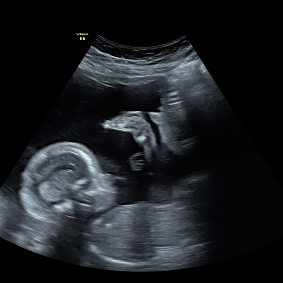 Photo shared by Hannah for their Babylist baby registry.