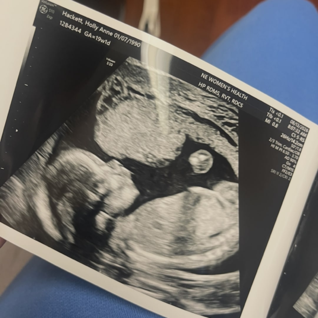 Photo shared by Holly for their Babylist baby registry.
