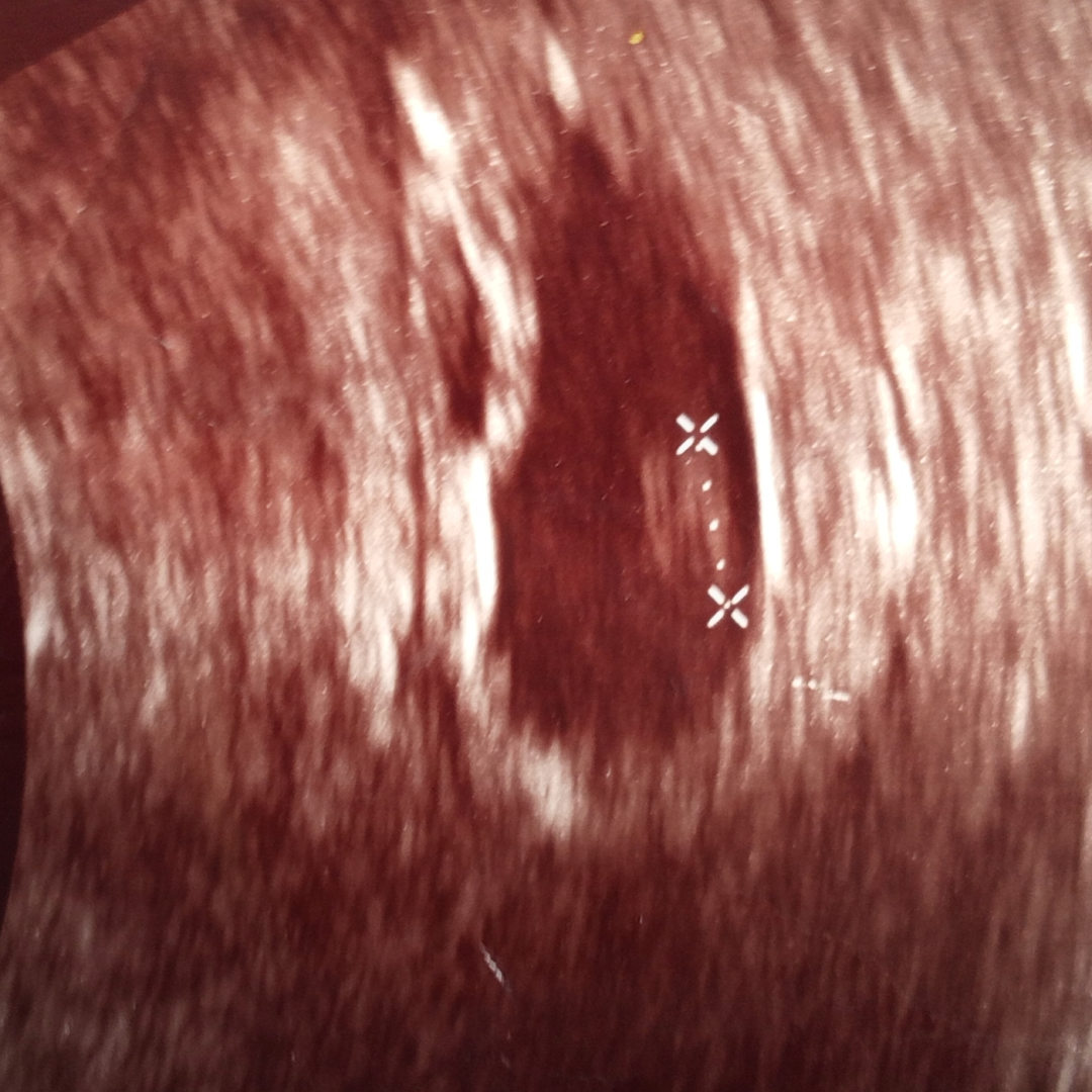 Photo shared by Alexis for their Babylist baby registry.
