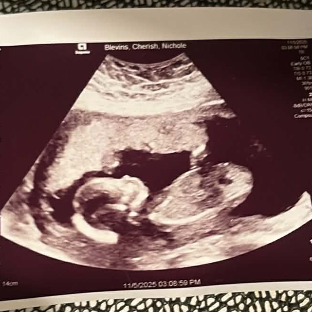 Photo shared by Cherish for their Babylist baby registry.