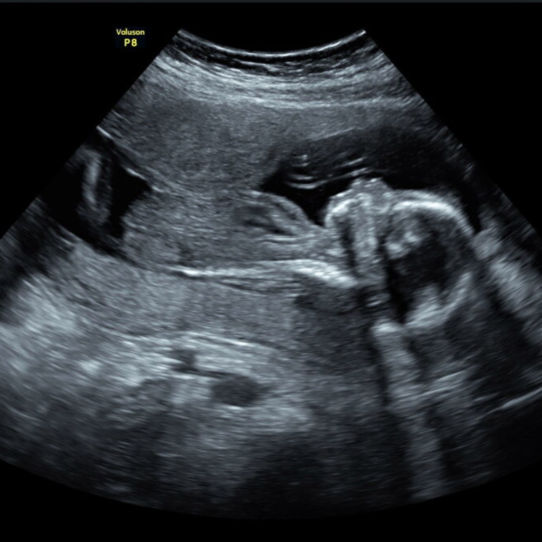 Photo shared by Ash for their Babylist baby registry.