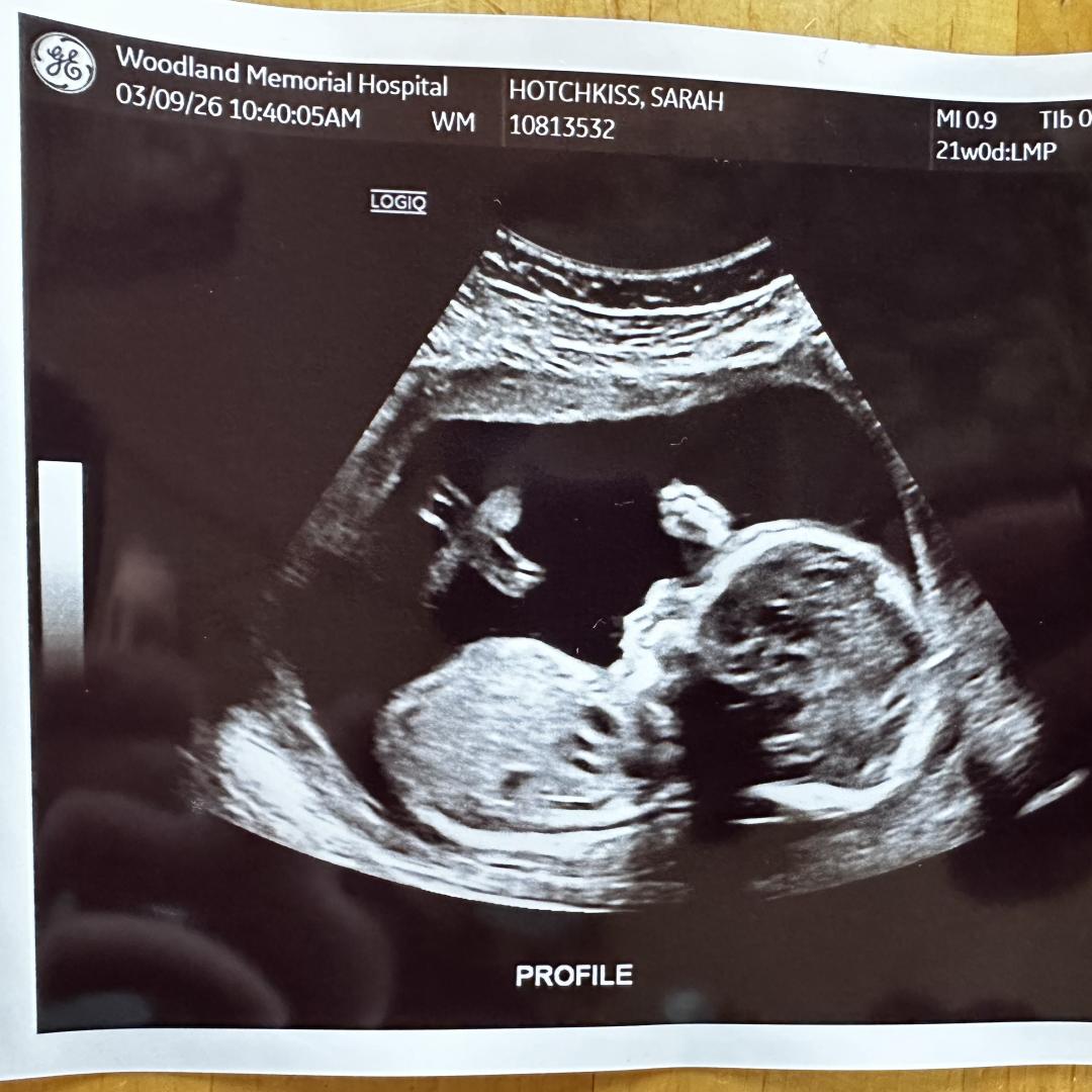 Photo shared by Sarah for their Babylist baby registry.
