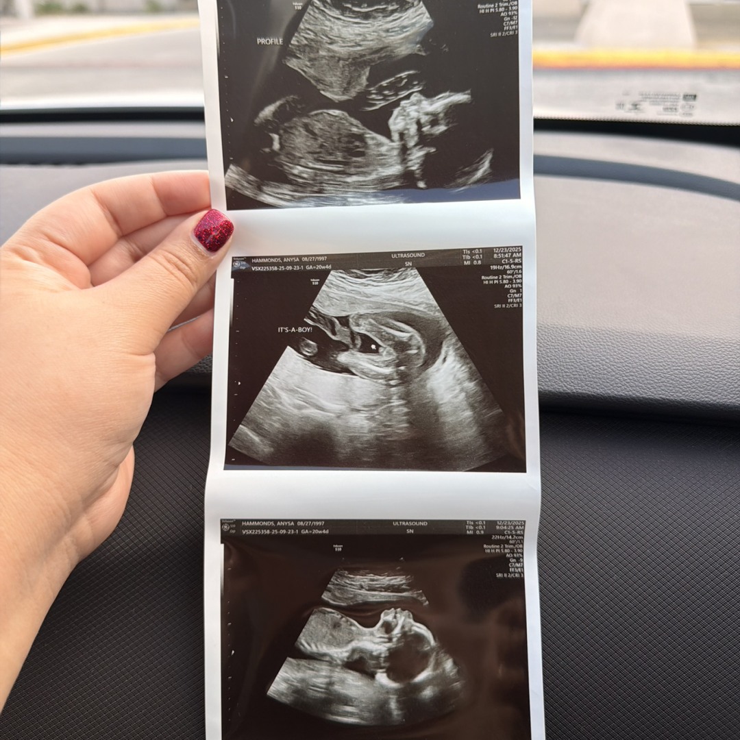 Photo shared by Anysa for their Babylist baby registry.