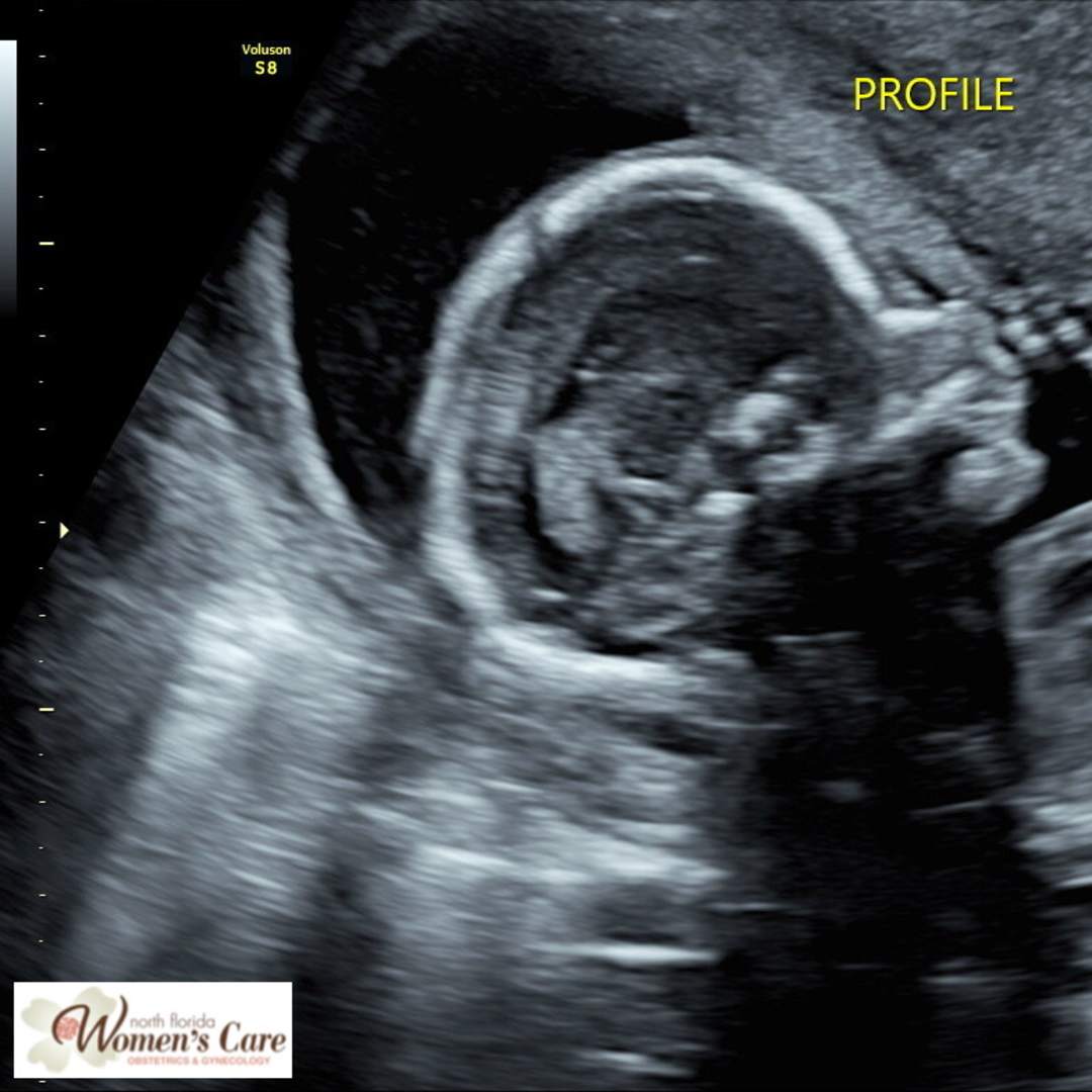 Photo shared by Aubrey for their Babylist baby registry.