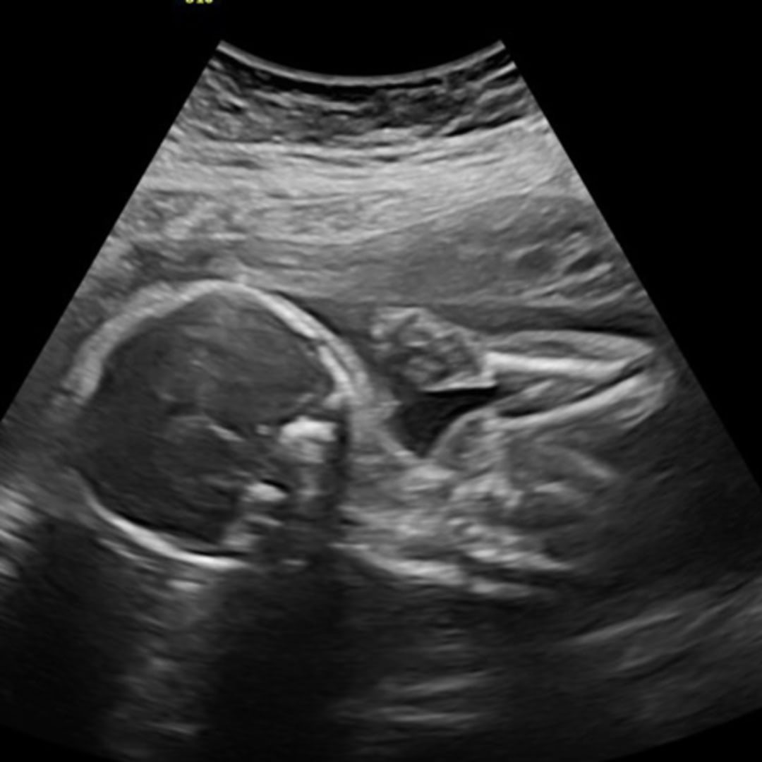 Photo shared by Rebecca for their Babylist baby registry.