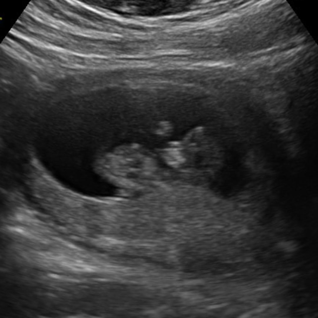 Photo shared by Ashley for their Babylist baby registry.