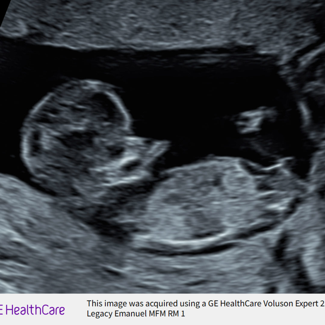 Photo shared by Ellee for their Babylist baby registry.