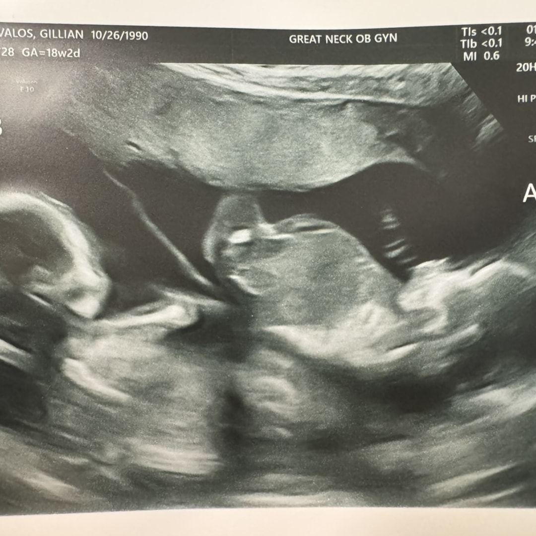 Photo shared by Gillian for their Babylist baby registry.