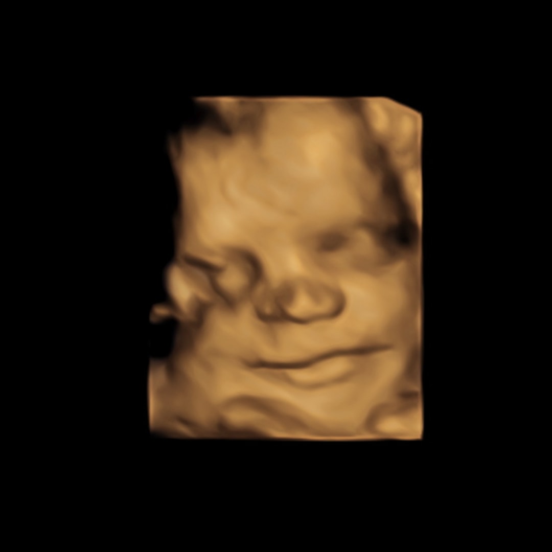 Photo shared by Harper for their Babylist baby registry.