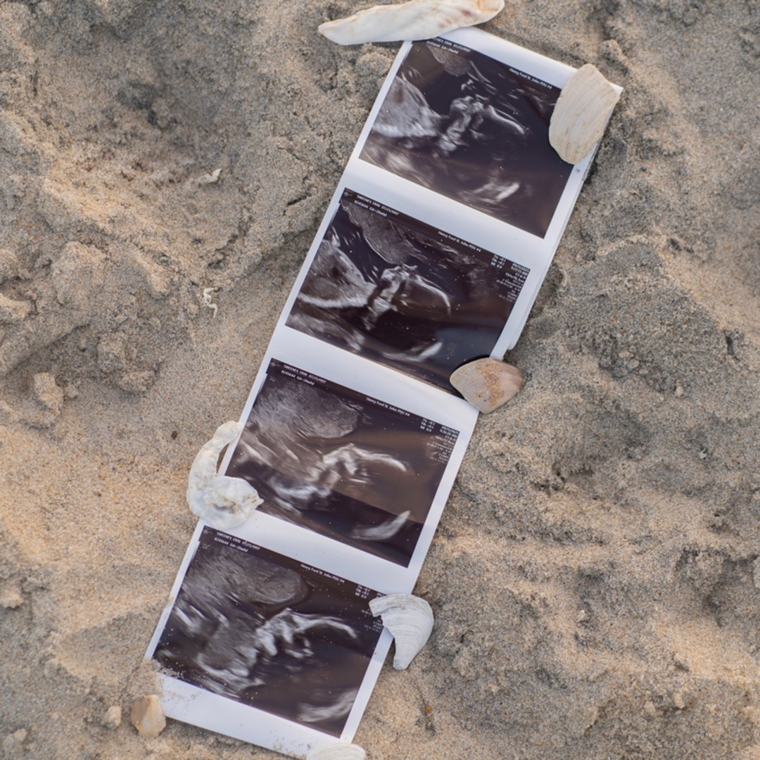 Photo shared by Erin for their Babylist baby registry.