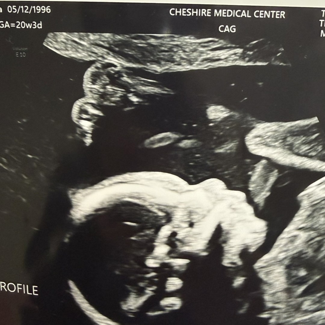 Photo shared by Shaina for their Babylist baby registry.