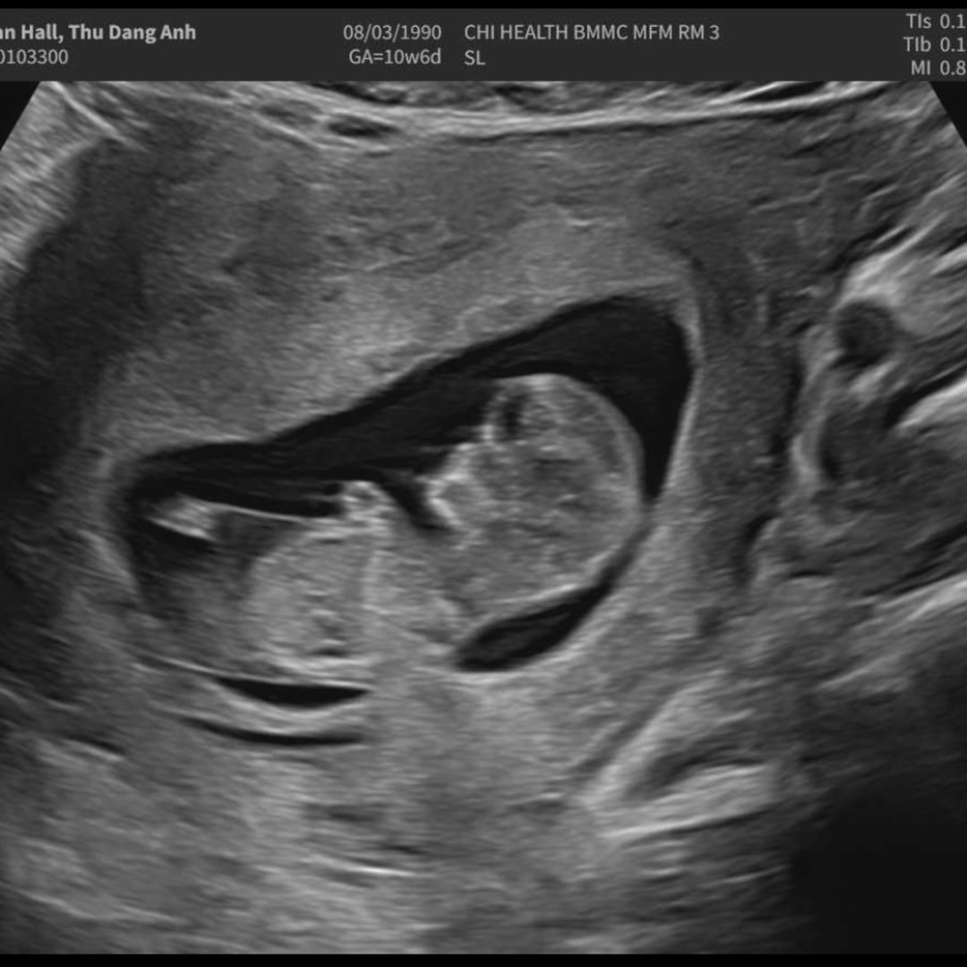 Photo shared by Thu for their Babylist baby registry.