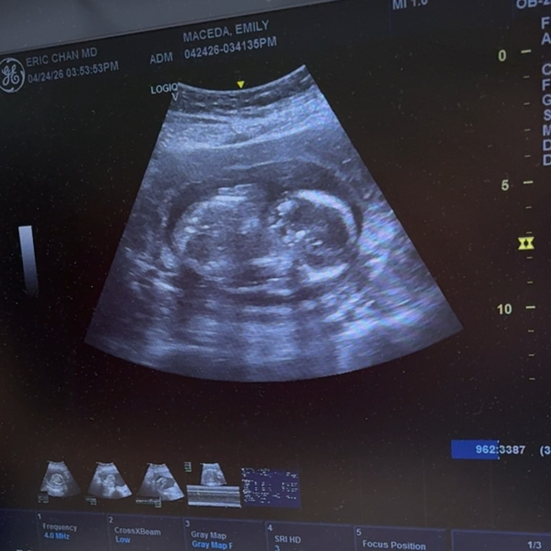 Photo shared by Emily for their Babylist baby registry.