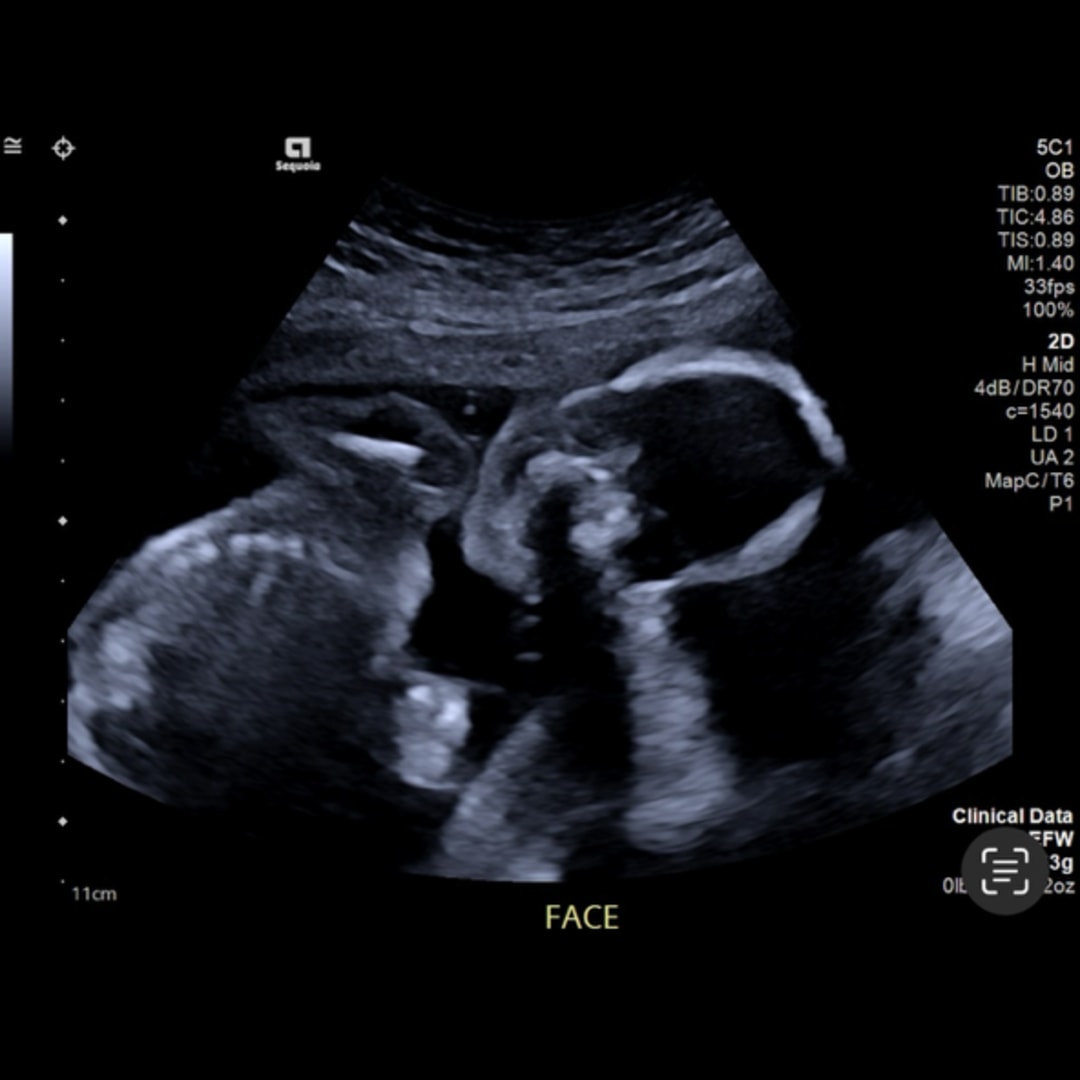 Photo shared by Lucia for their Babylist baby registry.
