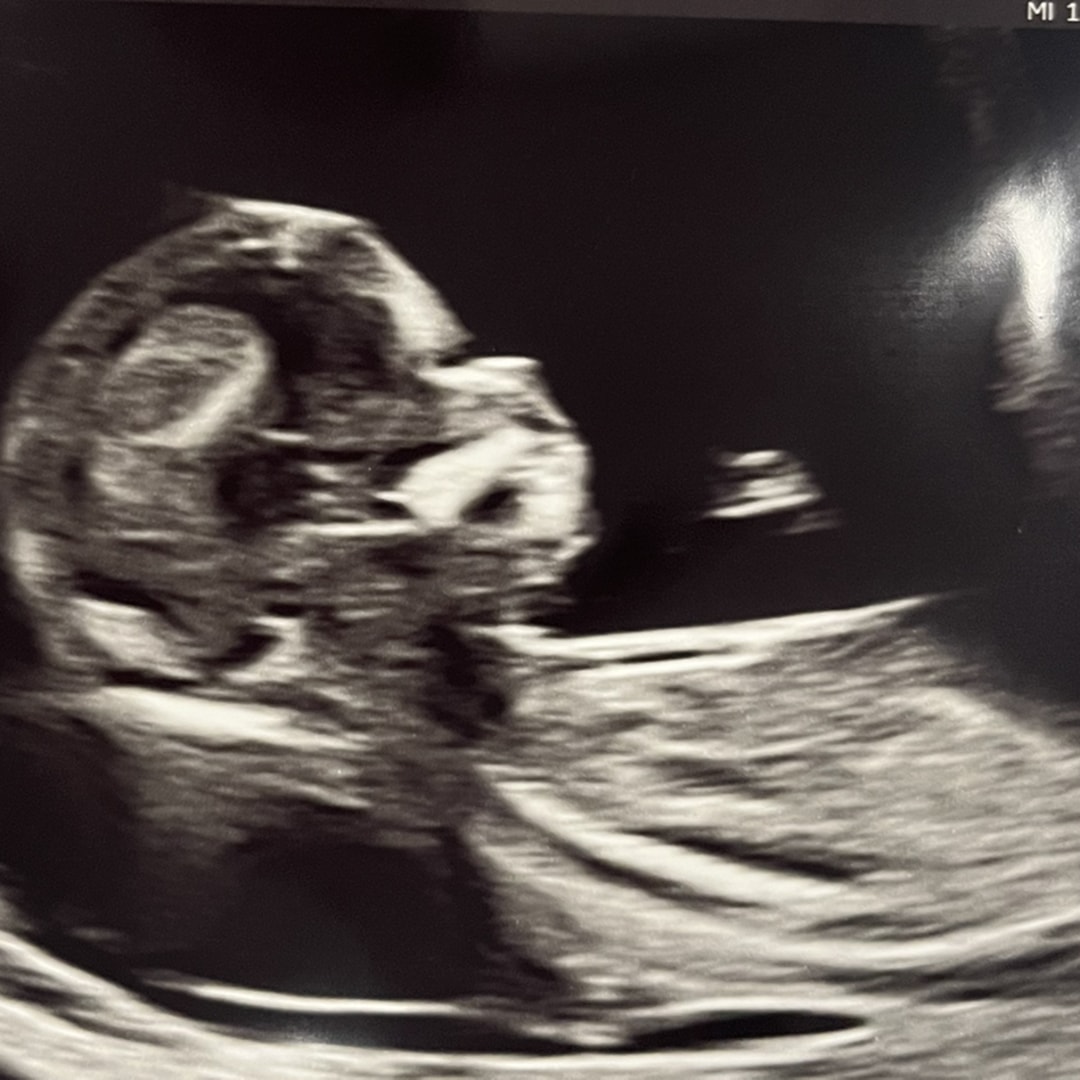 Photo shared by Princess for their Babylist baby registry.