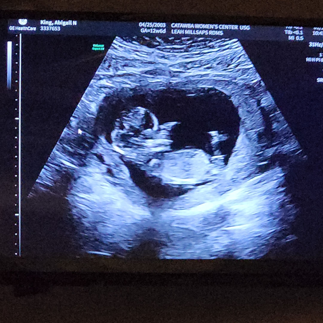 Photo shared by Abigail for their Babylist baby registry.