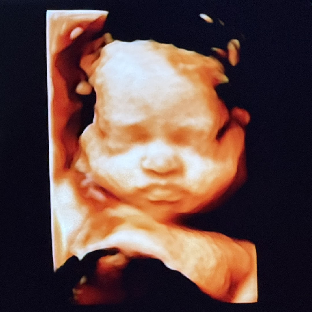 Photo shared by Brittney for their Babylist baby registry.