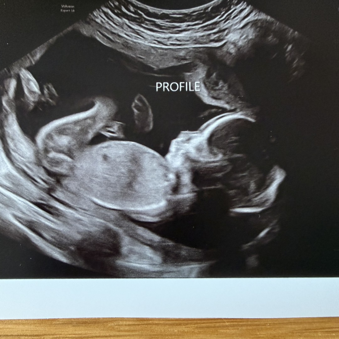 Photo shared by Julia for their Babylist baby registry.