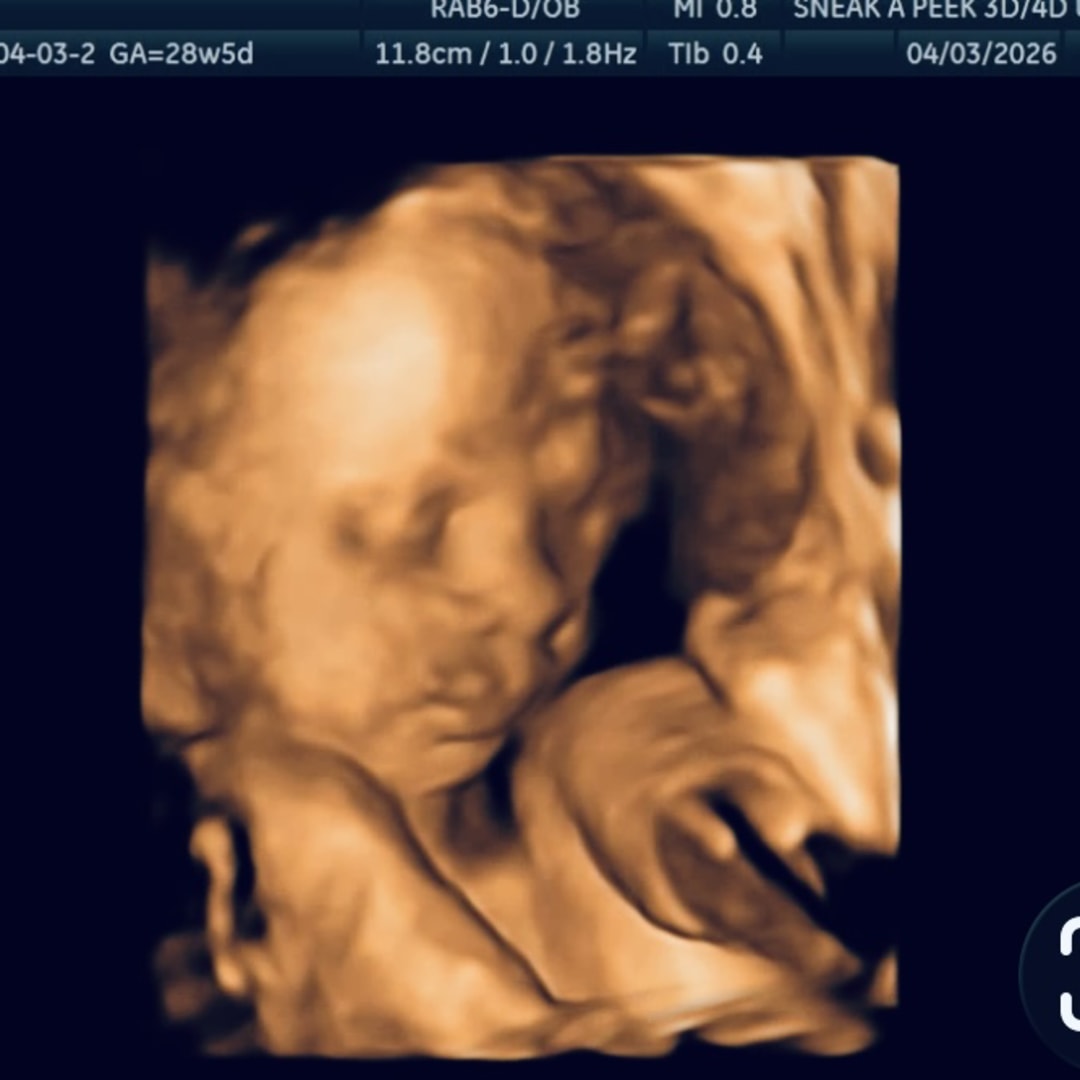 Photo shared by Erin for their Babylist baby registry.