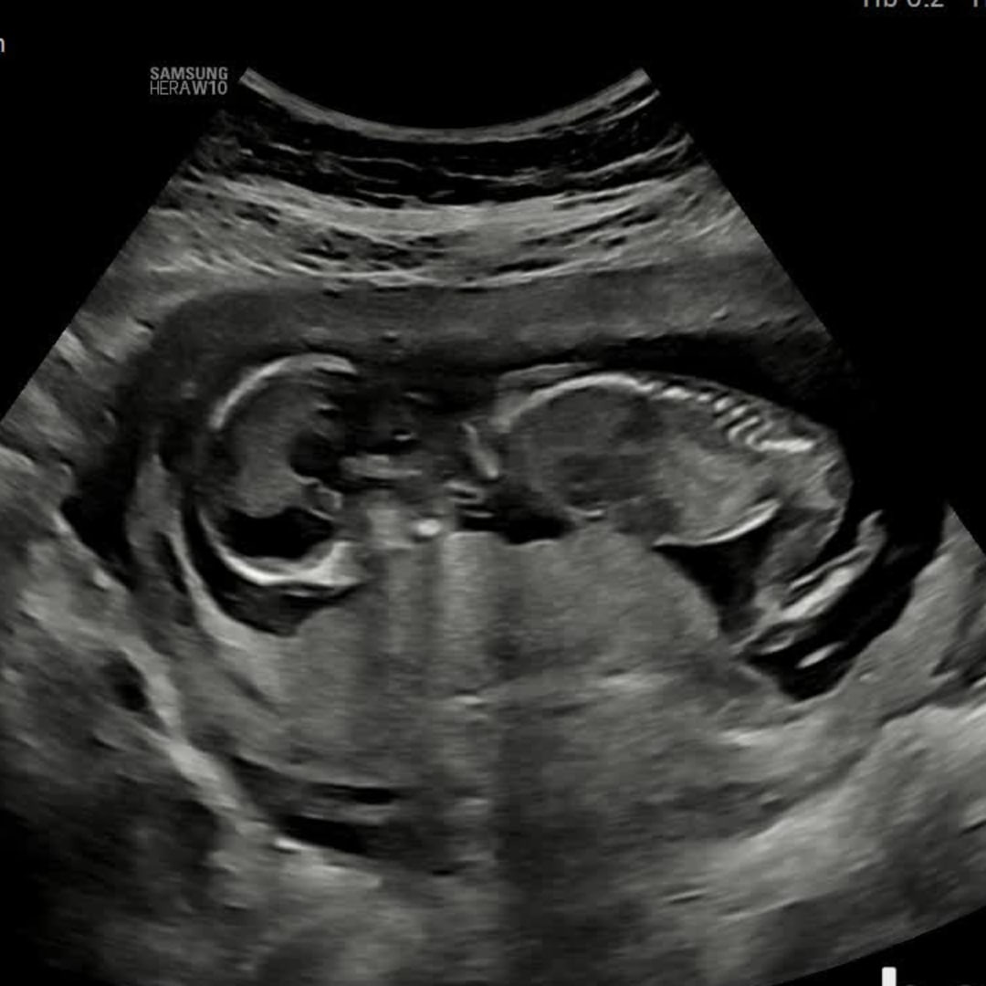 Photo shared by Makenzie for their Babylist baby registry.