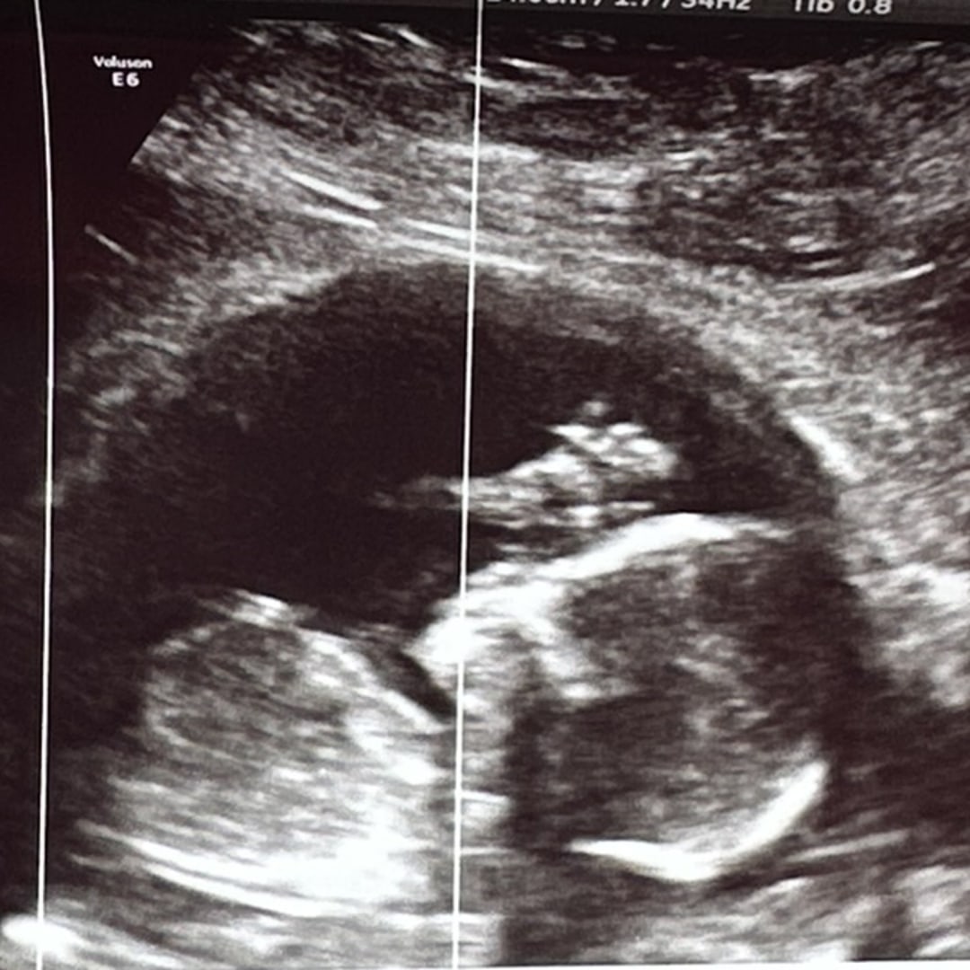 Photo shared by Hannah for their Babylist baby registry.