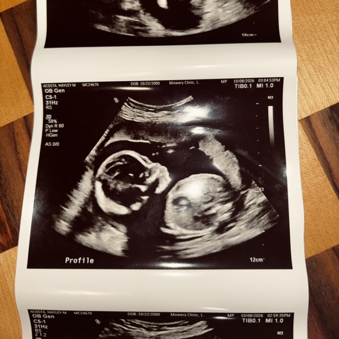 Photo shared by Hayley for their Babylist baby registry.
