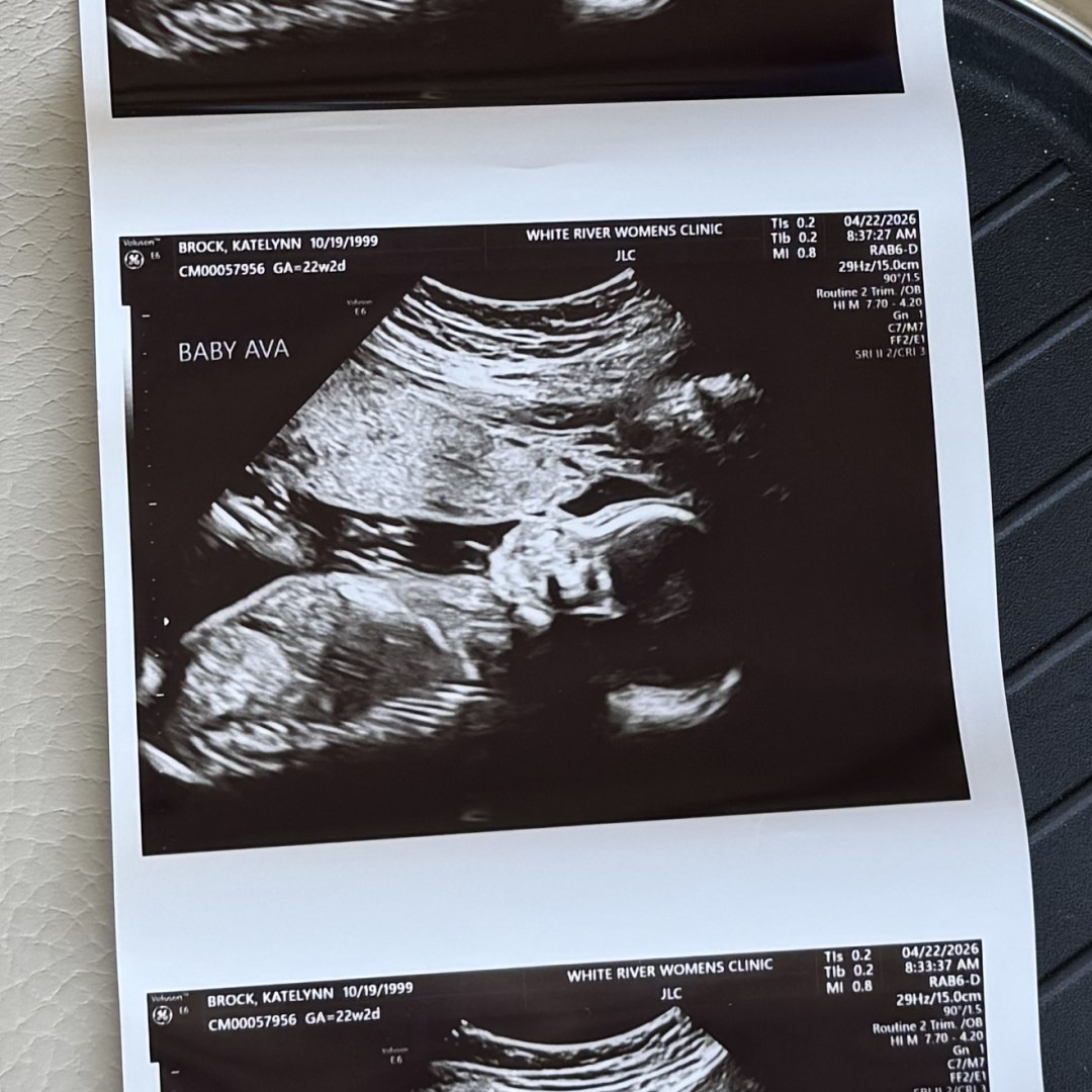 Photo shared by Katelynn for their Babylist baby registry.