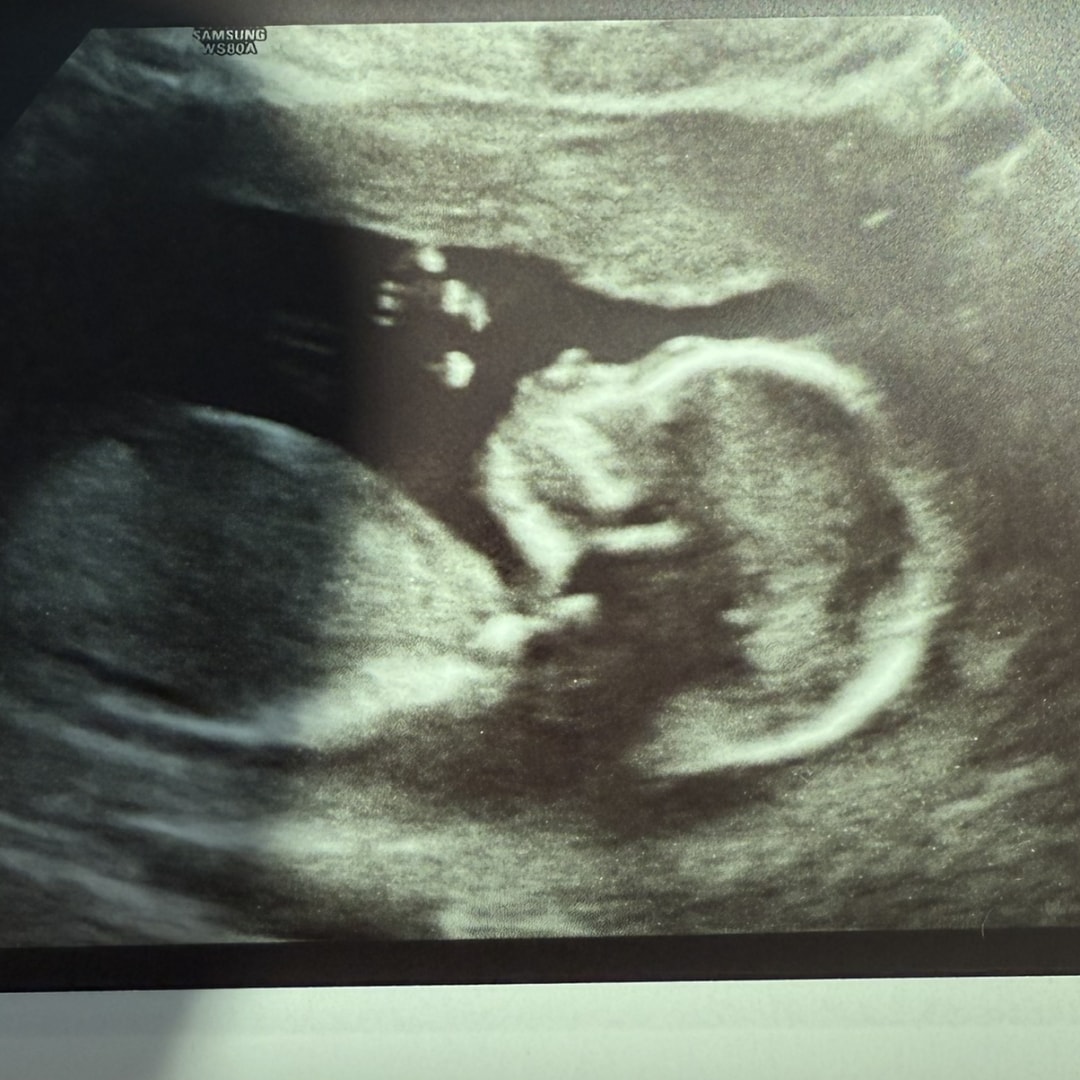 Photo shared by Sydney for their Babylist baby registry.