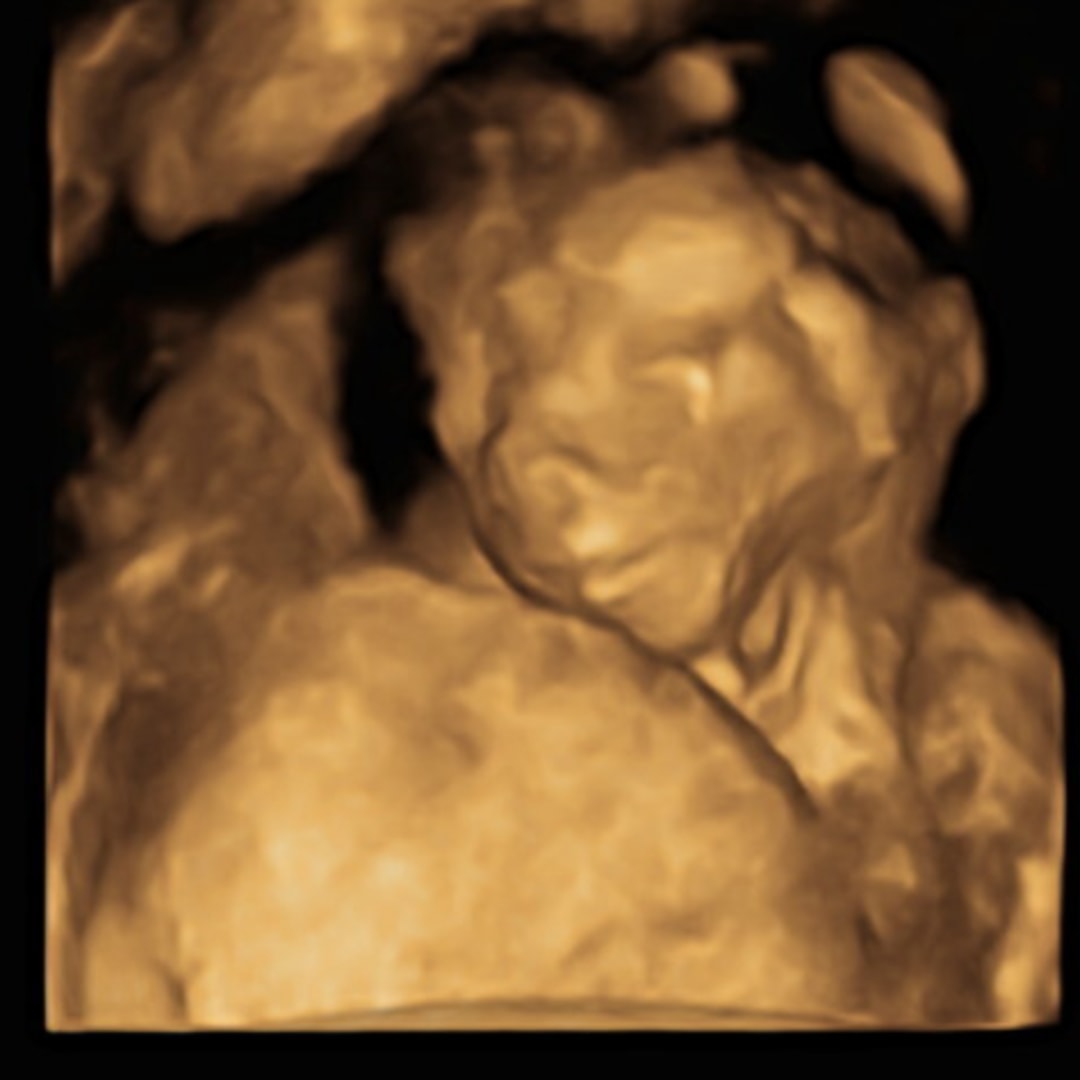 Photo shared by Sarai for their Babylist baby registry.