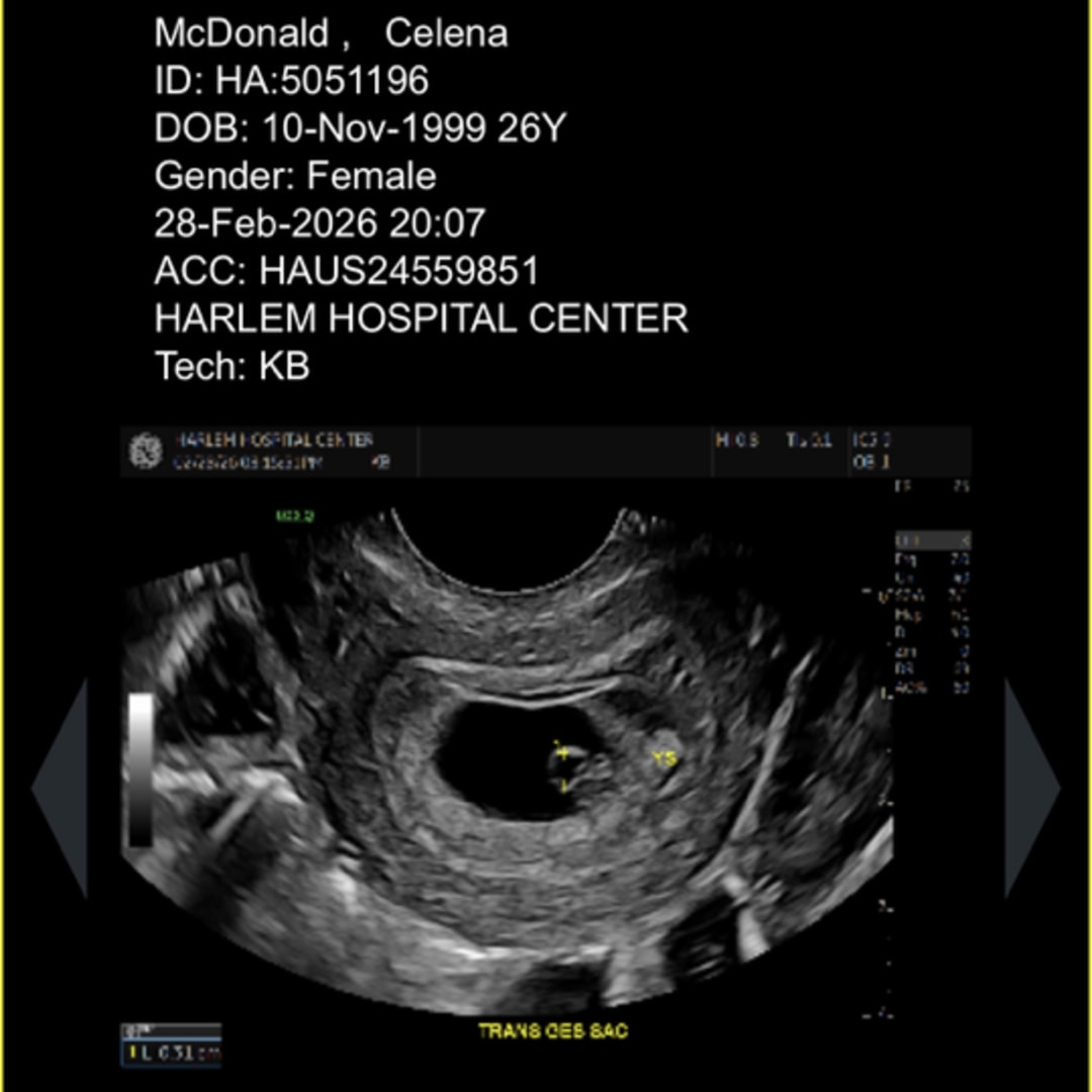 Photo shared by Celena for their Babylist baby registry.