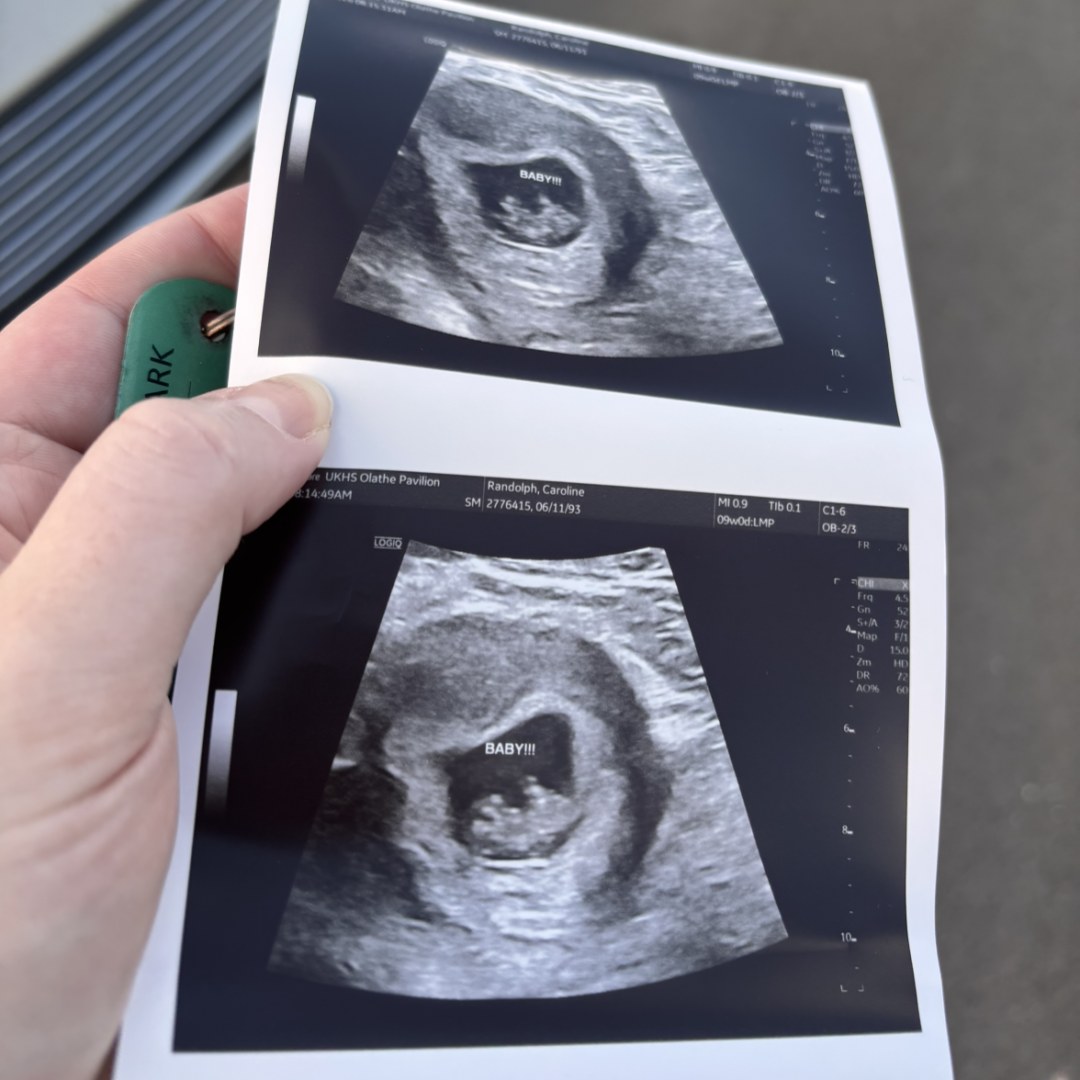 Photo shared by Caroline for their Babylist baby registry.