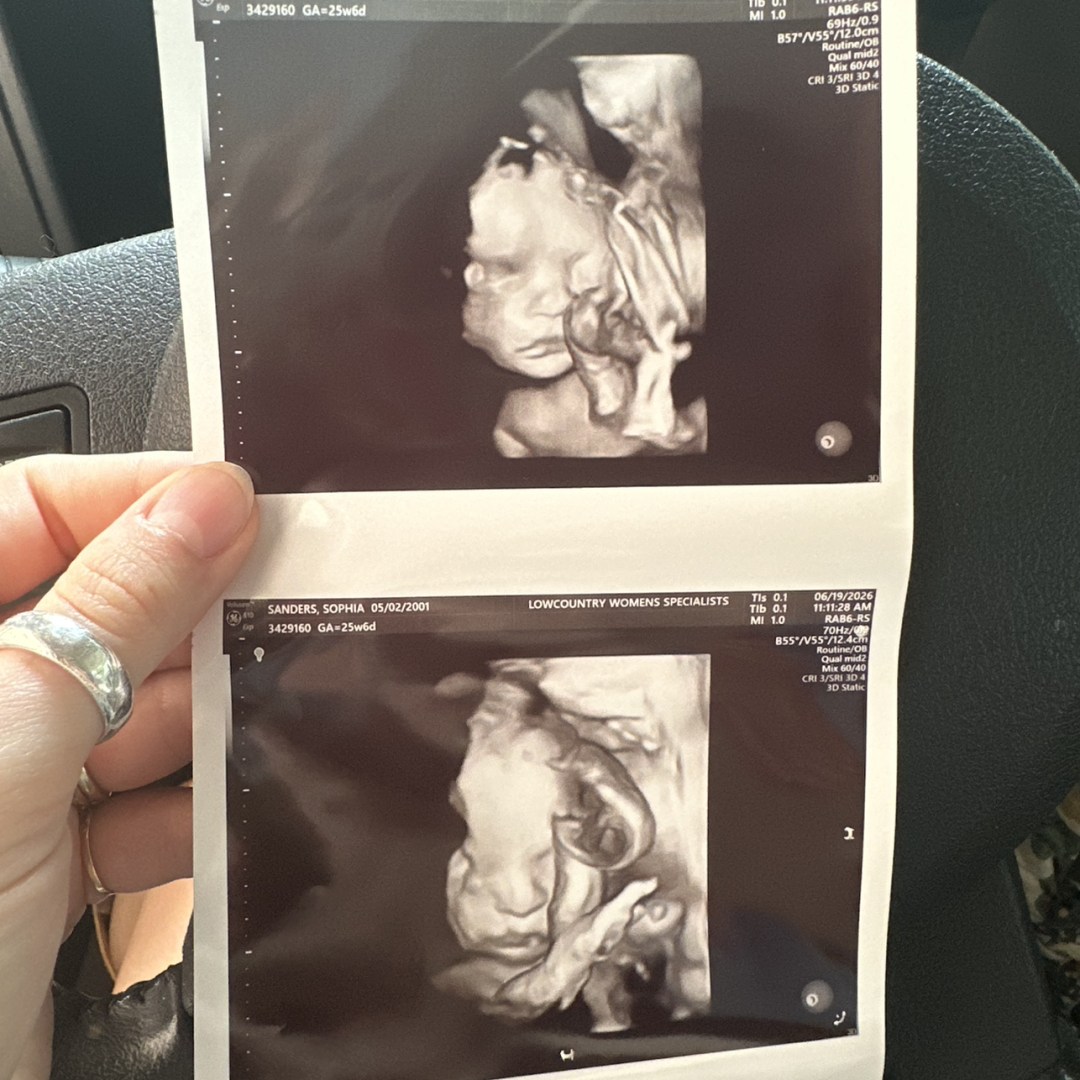 Photo shared by Sophie for their Babylist baby registry.