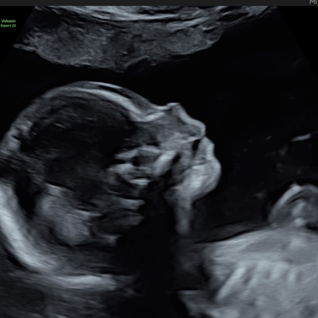 Photo shared by Sammi for their Babylist baby registry.