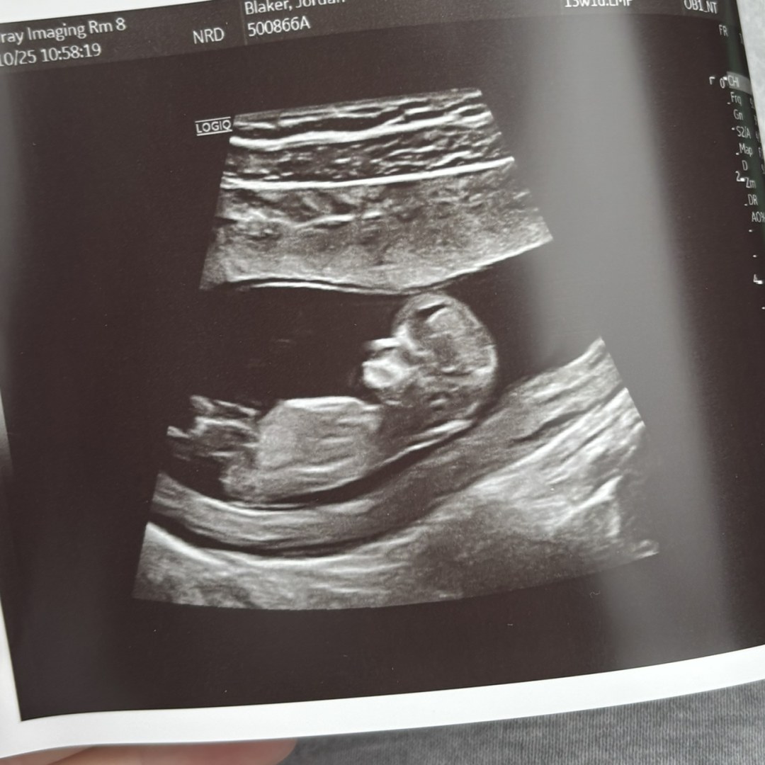 Photo shared by Jordan for their Babylist baby registry.