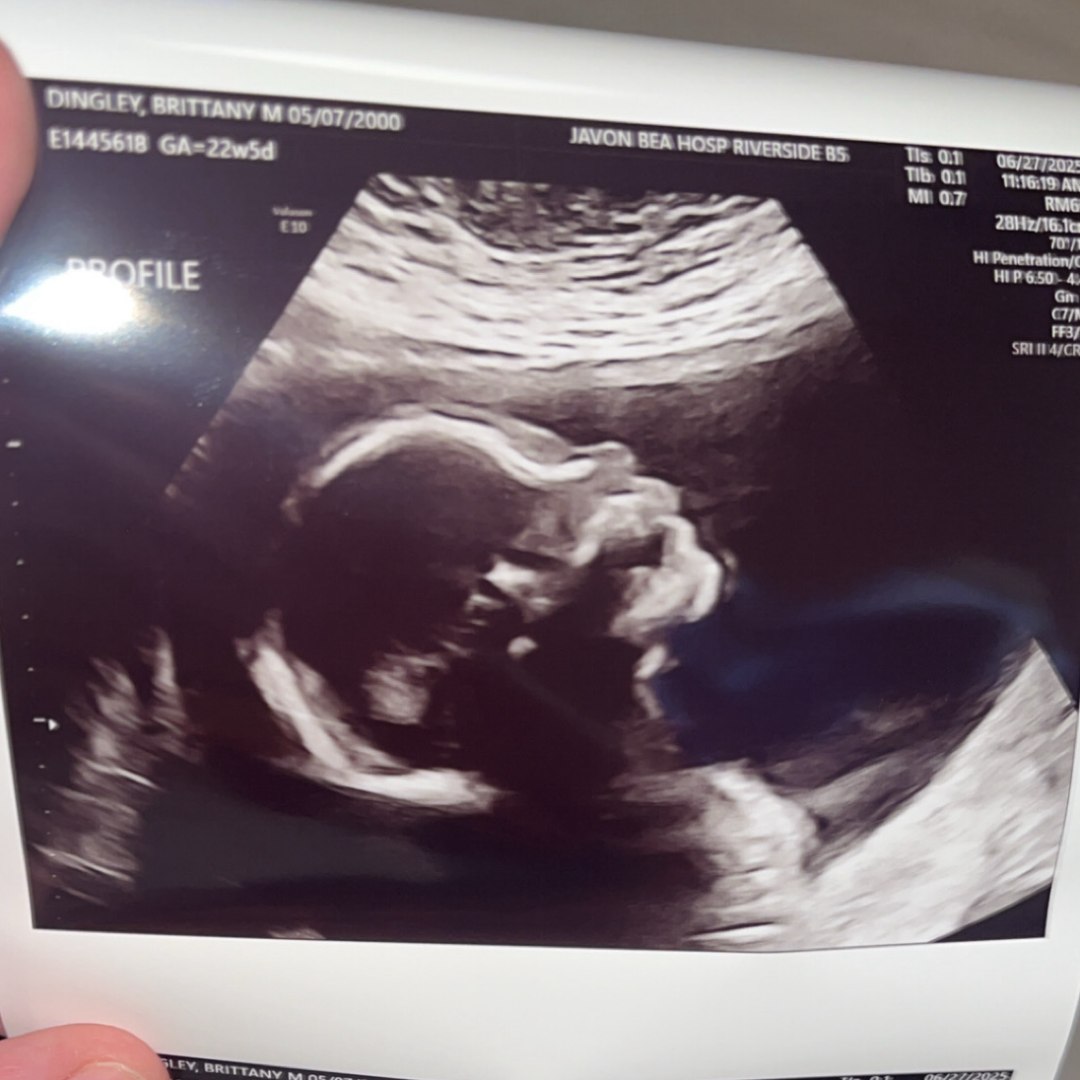 Photo shared by Brittany for their Babylist baby registry.
